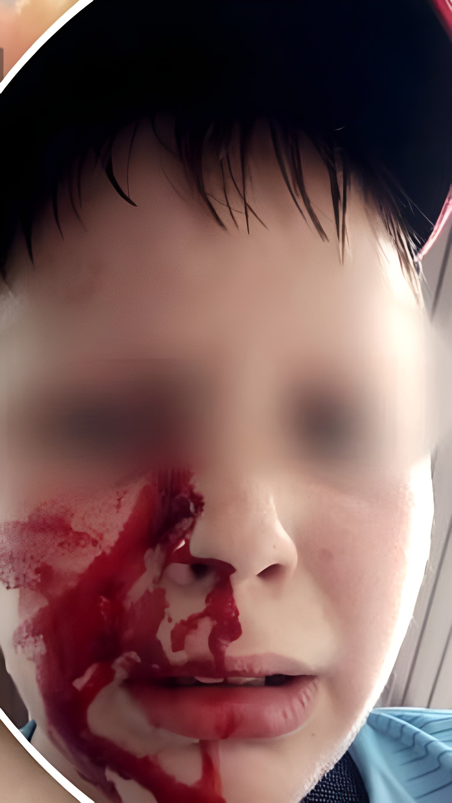 Школьник подвергся нападению на детской площадке в Новосибирске